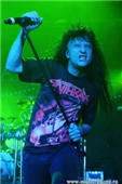 Anthrax